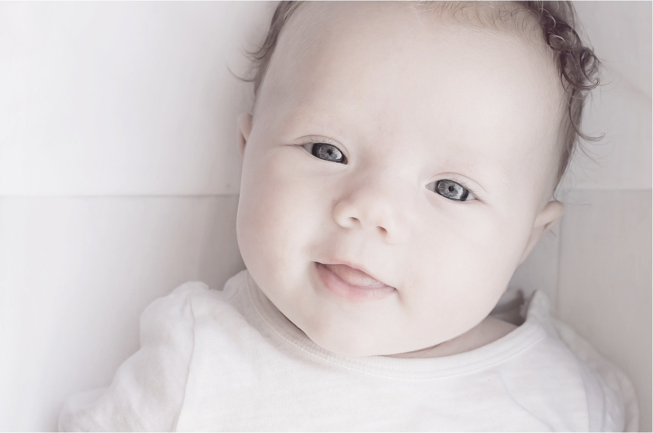Example of a left tilt right rotation Torticollis with ATNR also pictured